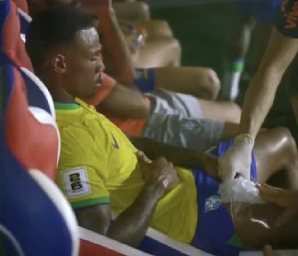 إصابة جابرييل مدافع أرسنال في مباراة البرازيل والسنغال