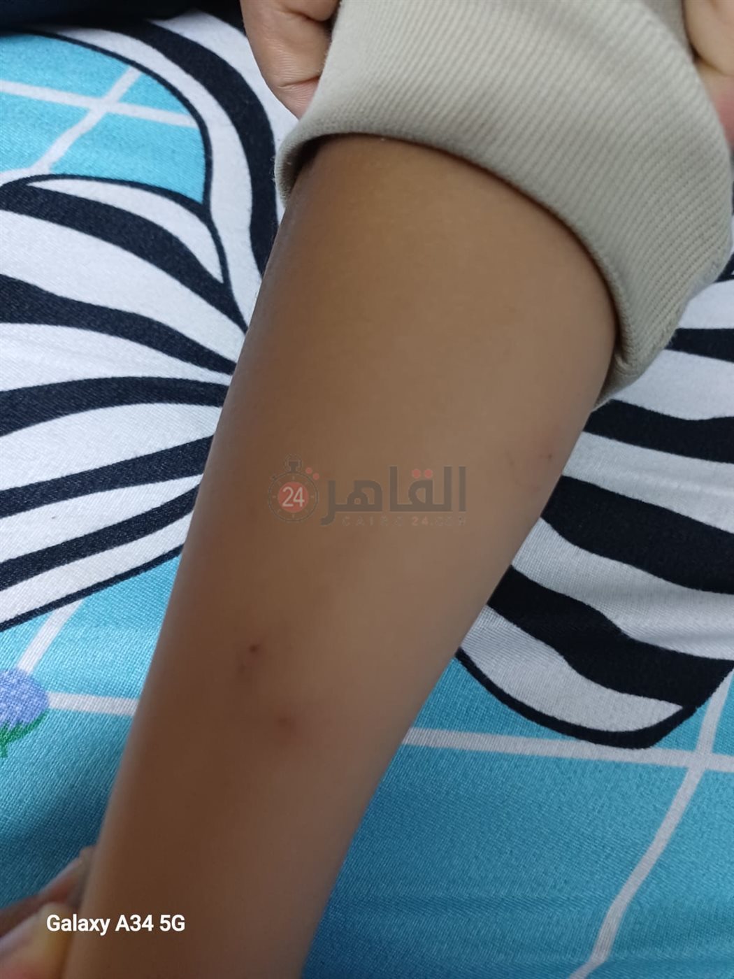 أولياء أمور مدرسة بالقاهرة يستغيثون من انتشار حشرات البق داخل الفصول