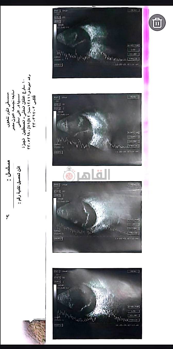 التقرير الطبي