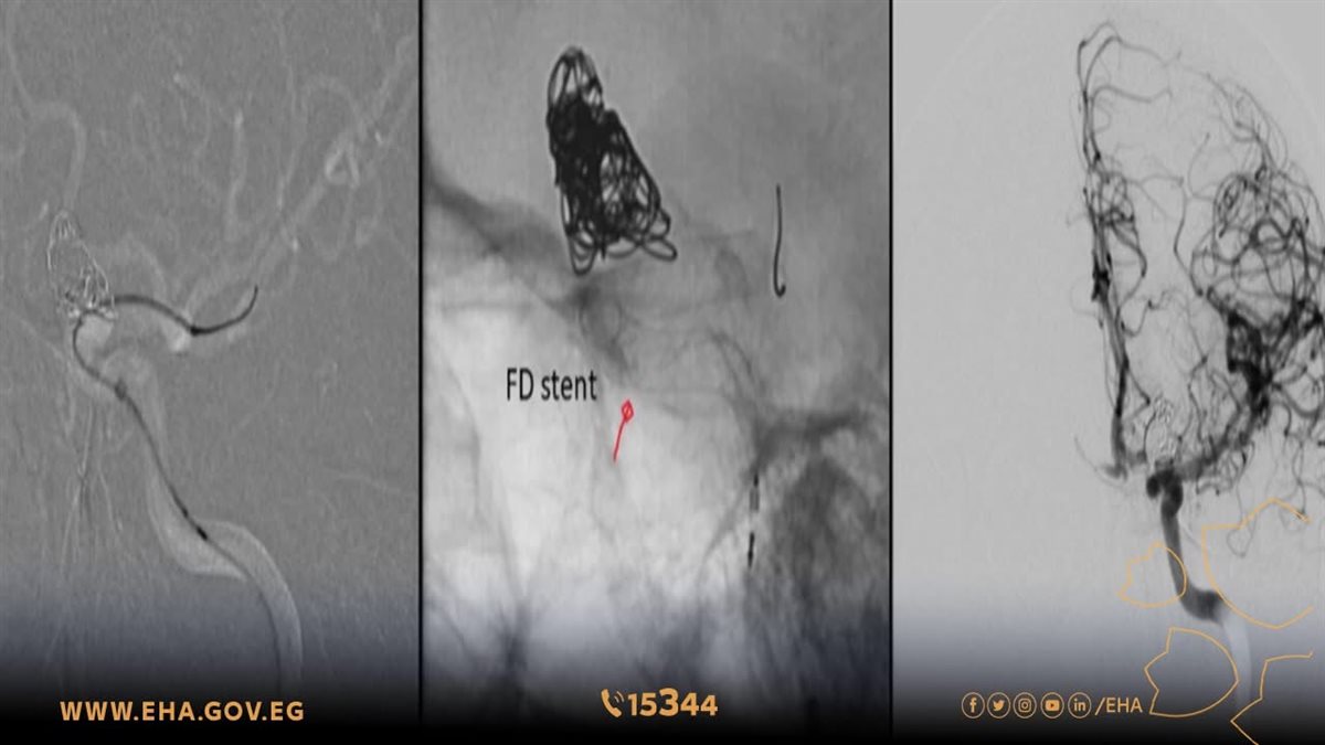 مستشفى إسنا
