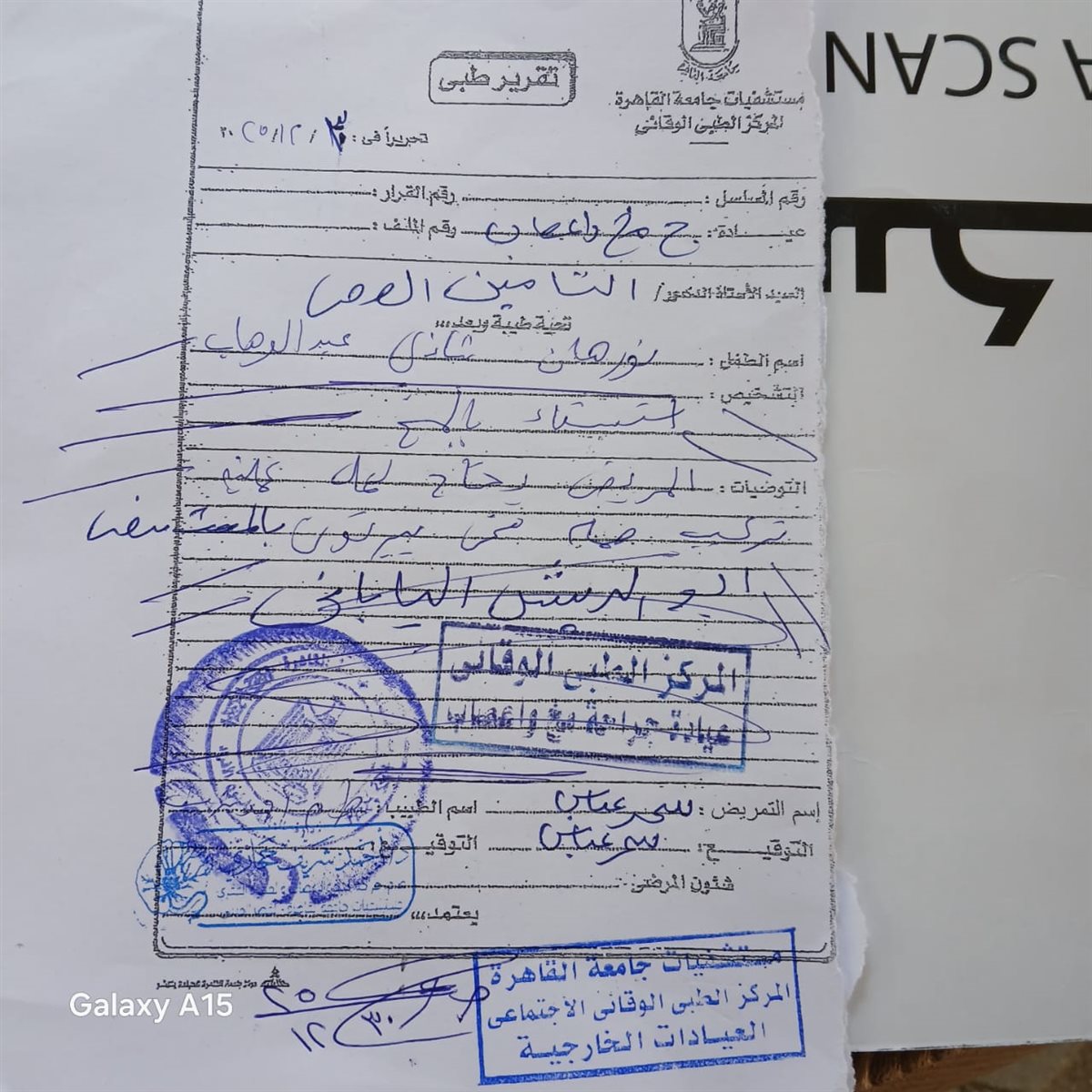 <strong>والد يستغيث لإجراء عملية صمام في المخ لإنقاذ حياة ابنته</strong>