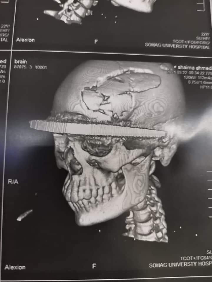 WhatsApp Image 2021-03-22 at 3.39.43 PM (1)