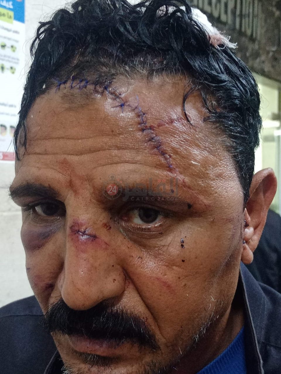 cbd23bc5-1505-478c-ad54-8a246e78d6c5