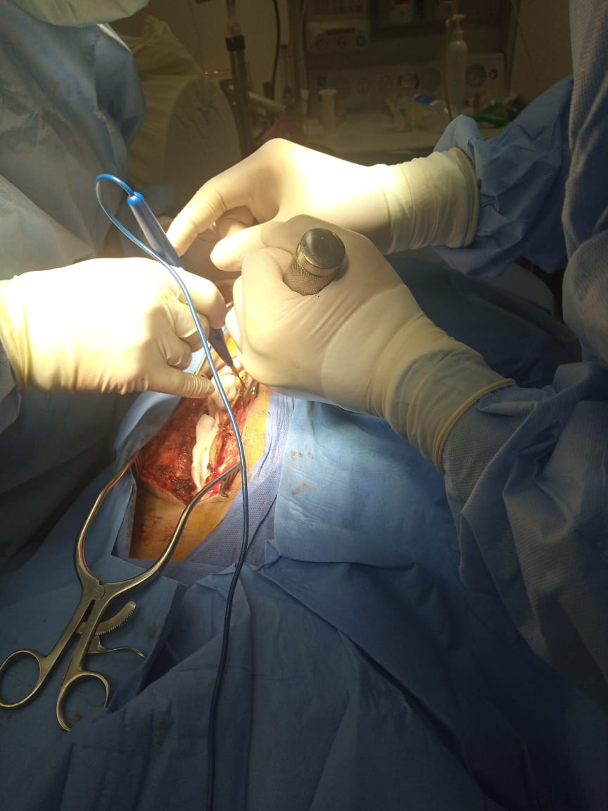 03378b86-5793-4505-89b8-b8792d5bd85b