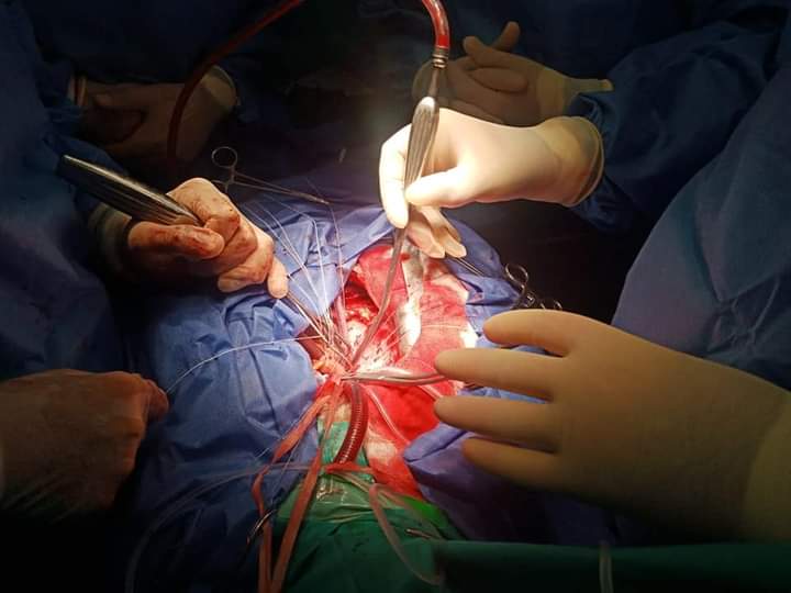 أثناء إجراء العملية