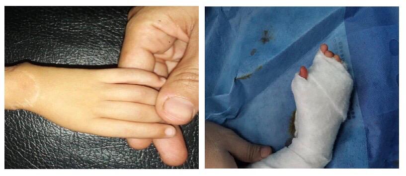 قبل وبعد إجراء الجراحة