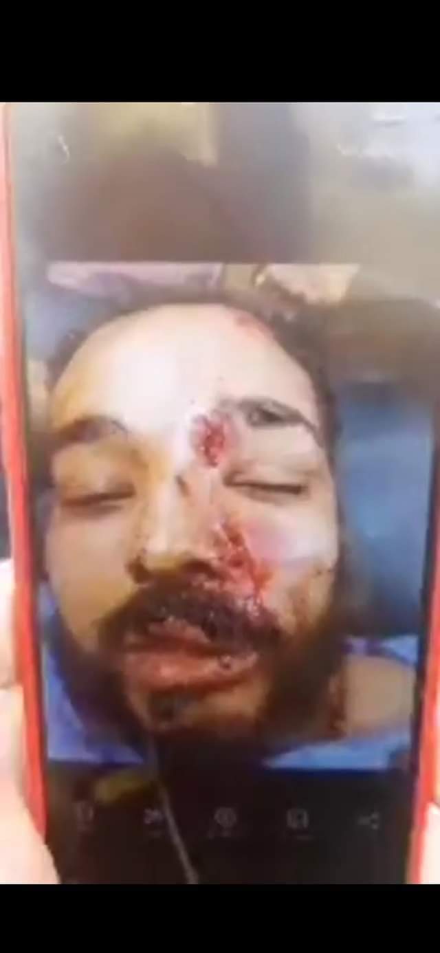 e717b5ea-bc47-43b7-aeab-14b9e3eaa1be