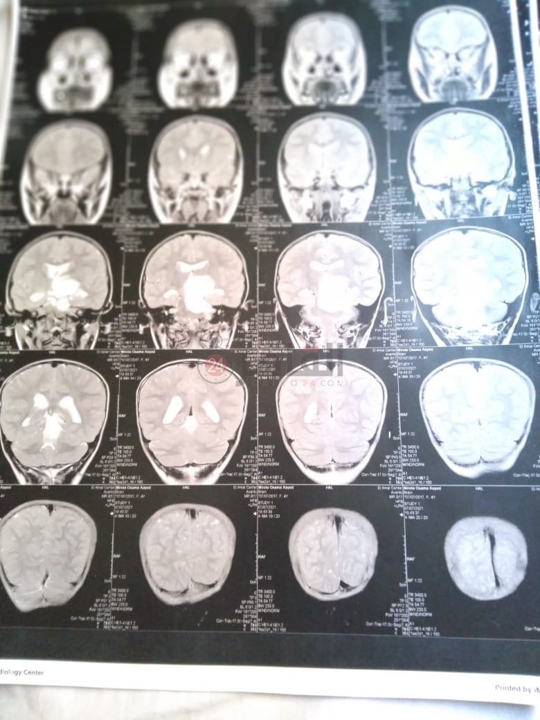 dd557a77-9866-4aa0-9f76-ce9ef5d8d815