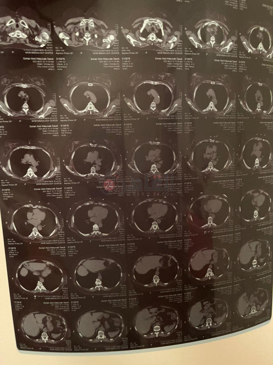 dcbd8fbd-22cb-43a2-8883-2d14df54ba76