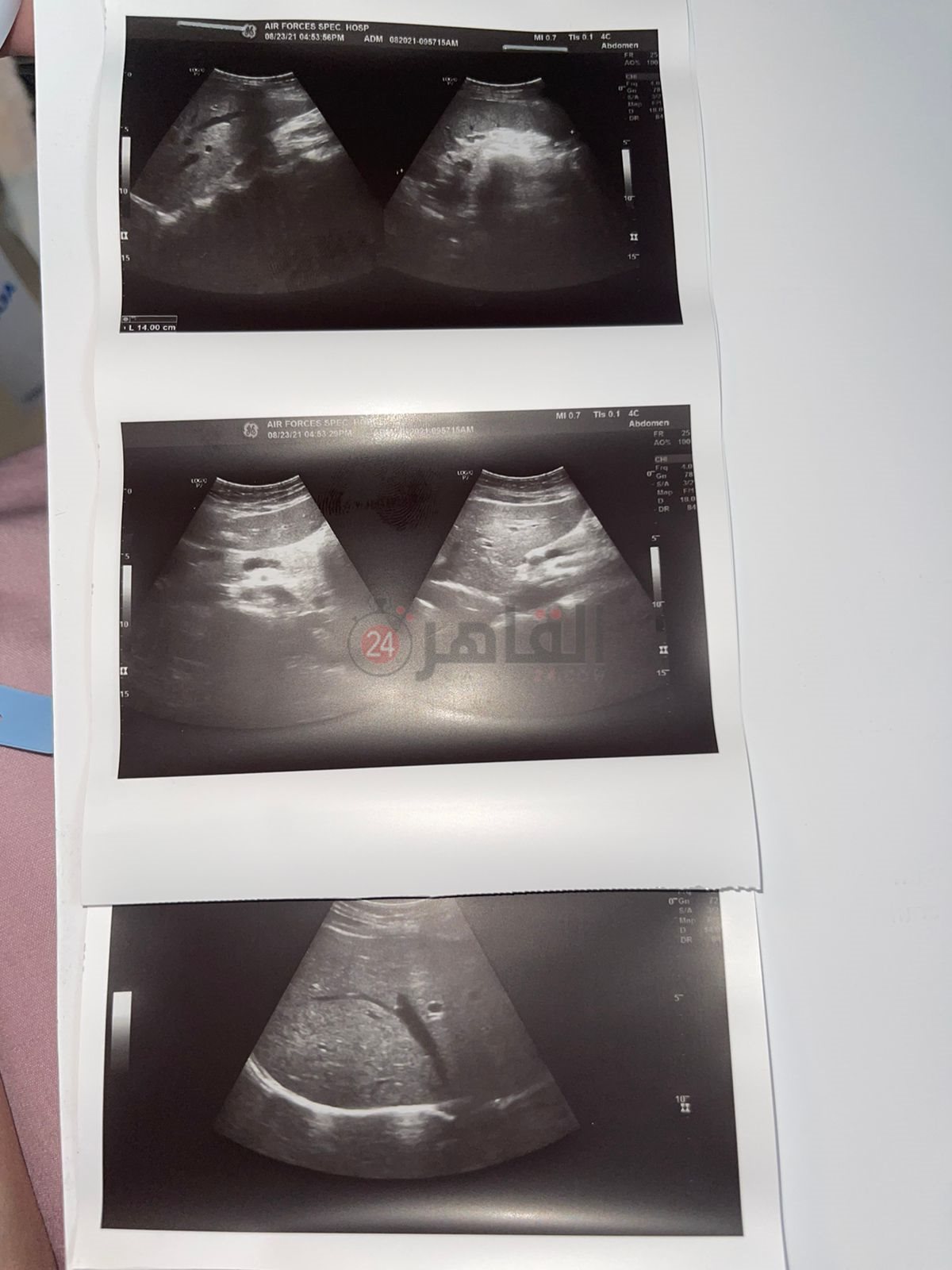 f3d515b5-7a7d-47a2-b933-8a87f3086221