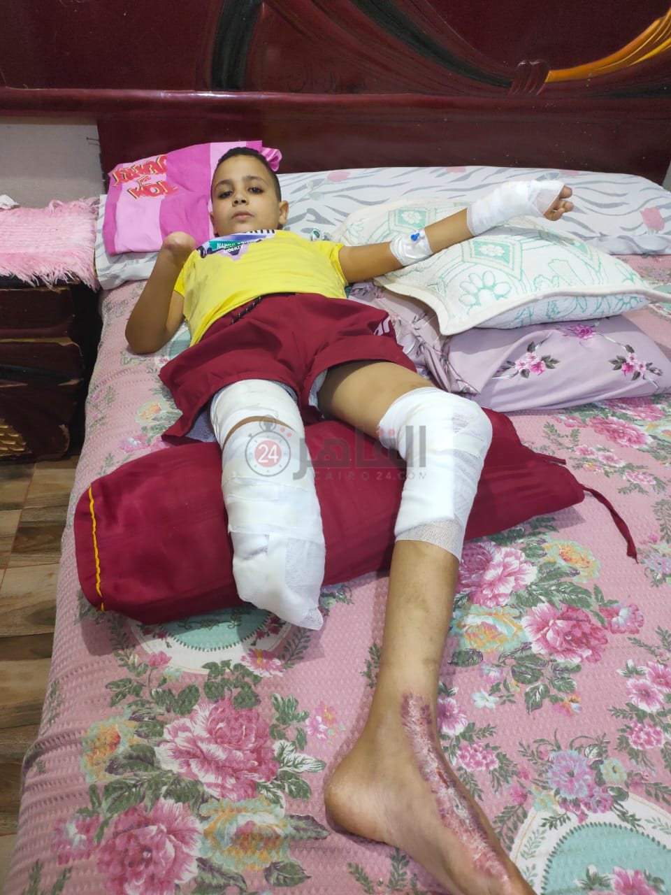 الطفل المجني عليه