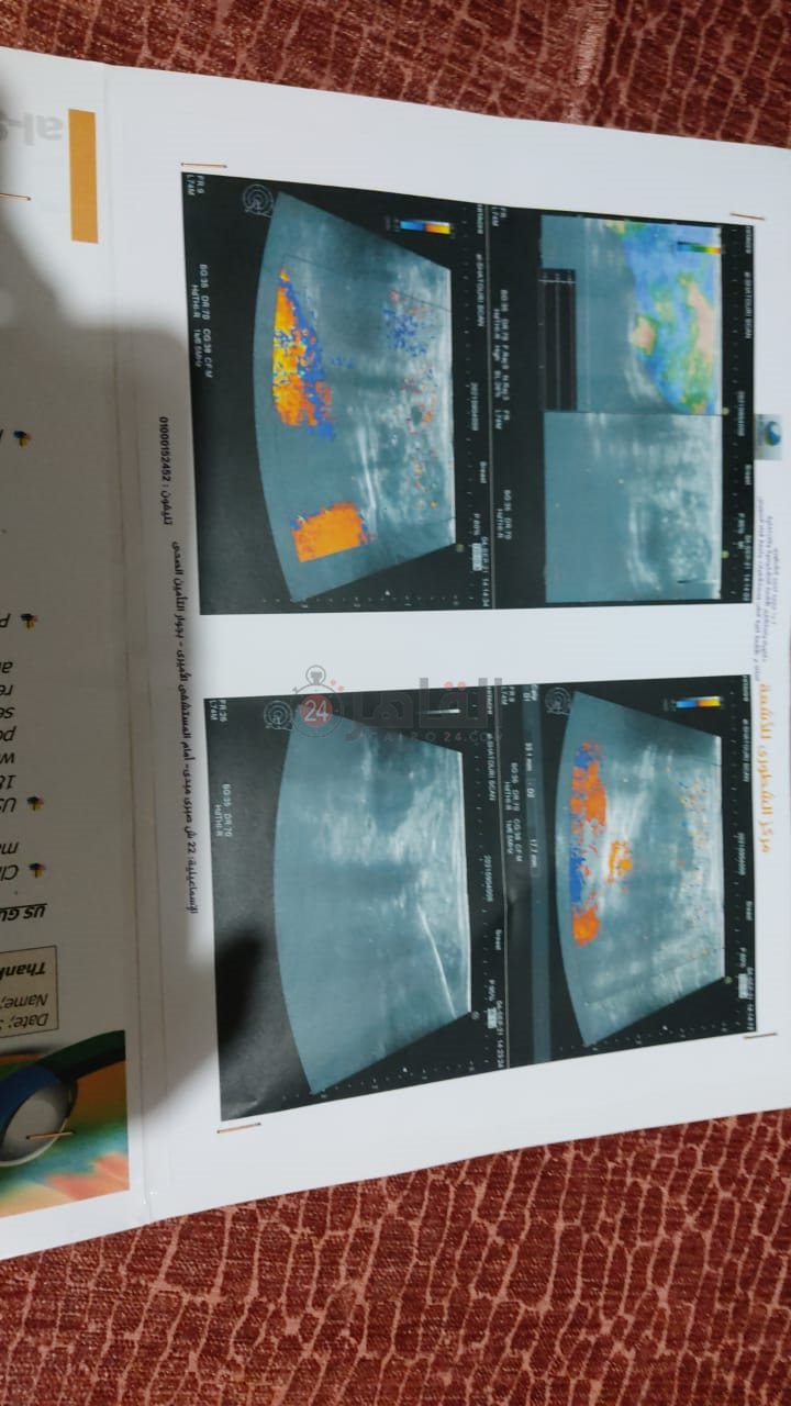 تقارير طبية بحالة أمل 03