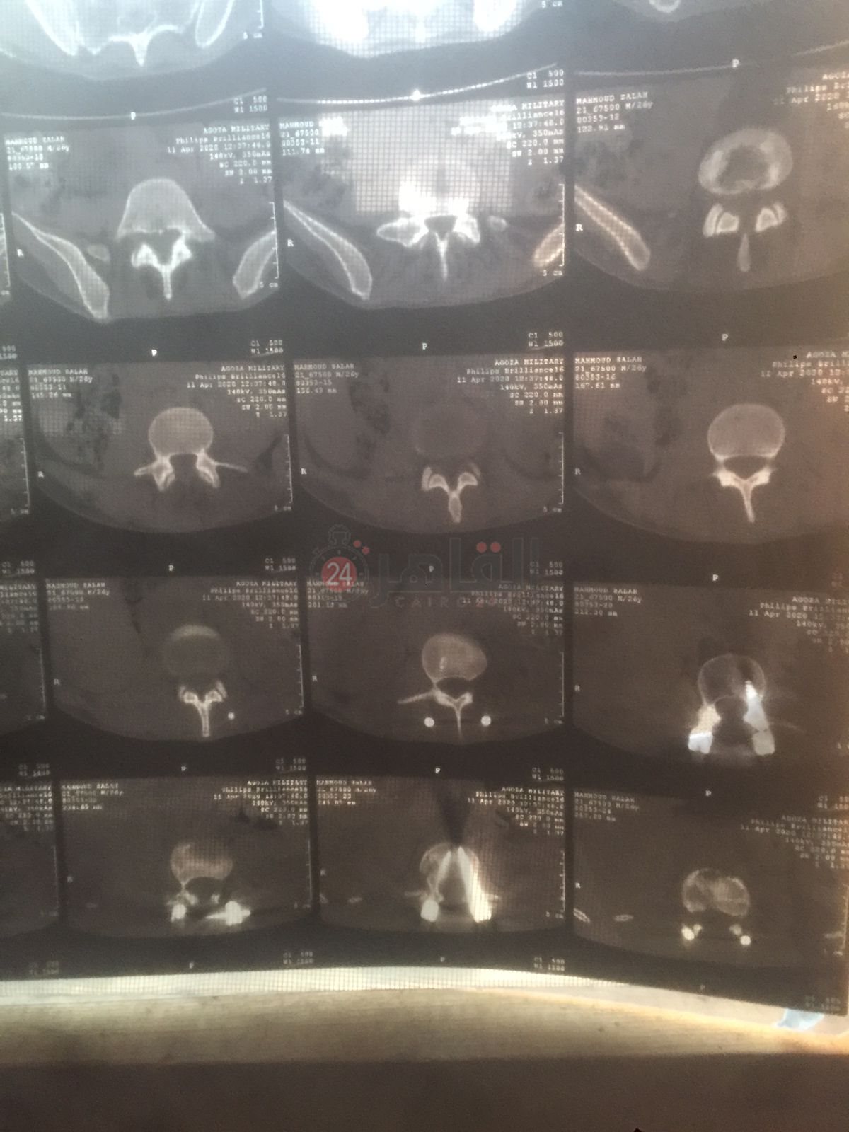 4f044625-600d-42e1-afb5-70bef142d03a