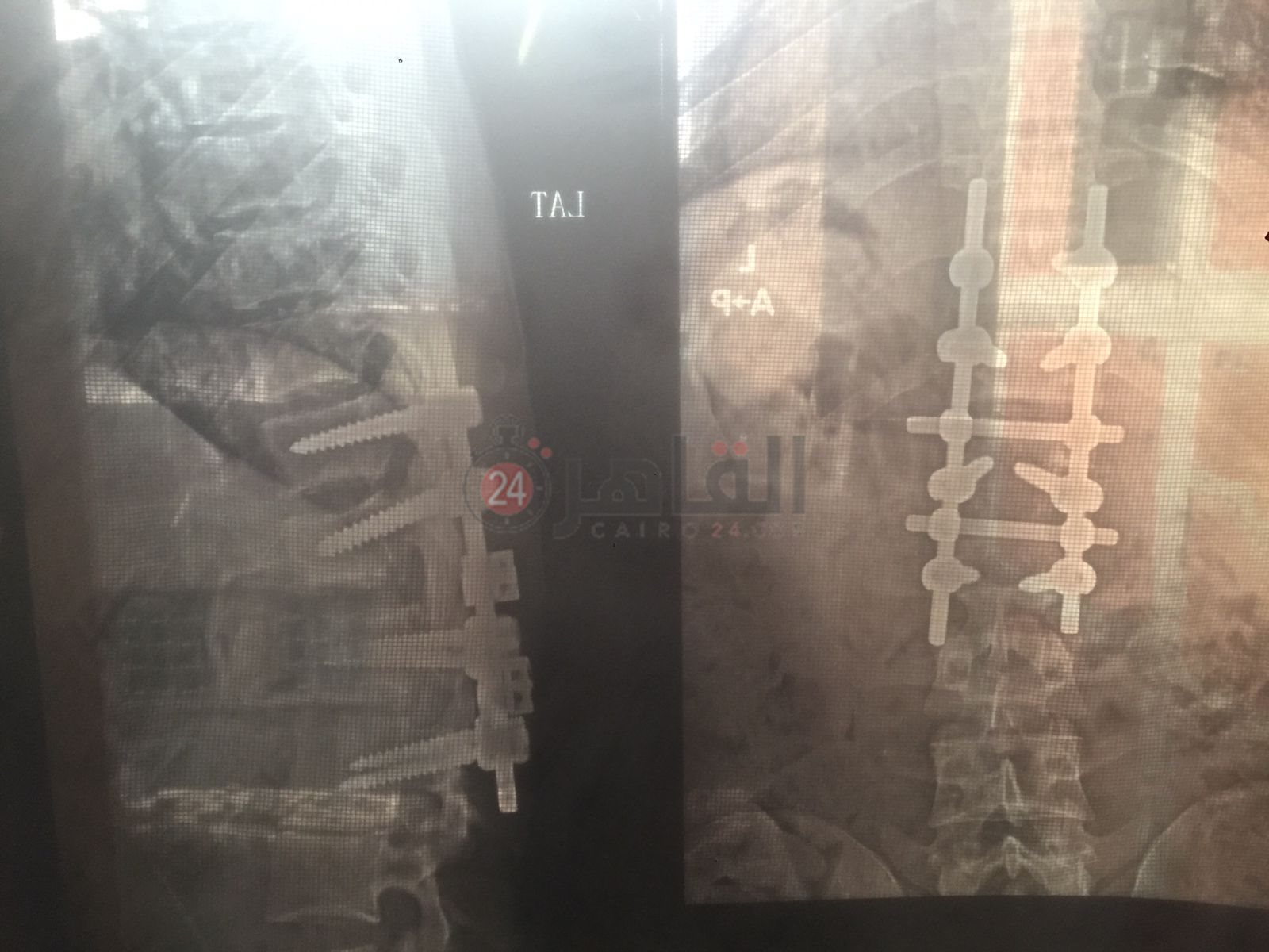 9ac587bd-3c8d-47b0-a95d-1bd6c4bfe981