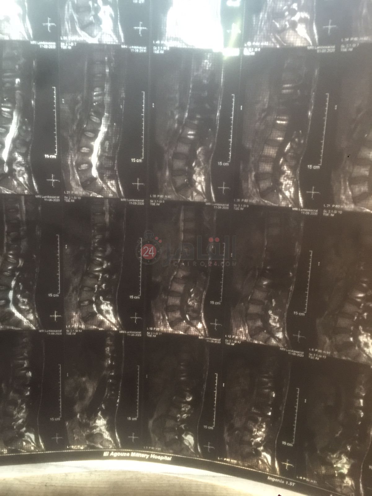 71ae0f9d-849e-4c74-bfd6-7515a78a4ede