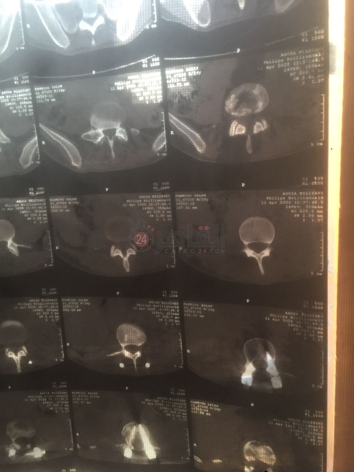 577562d2-74c0-4a3c-9b79-b905627bd421