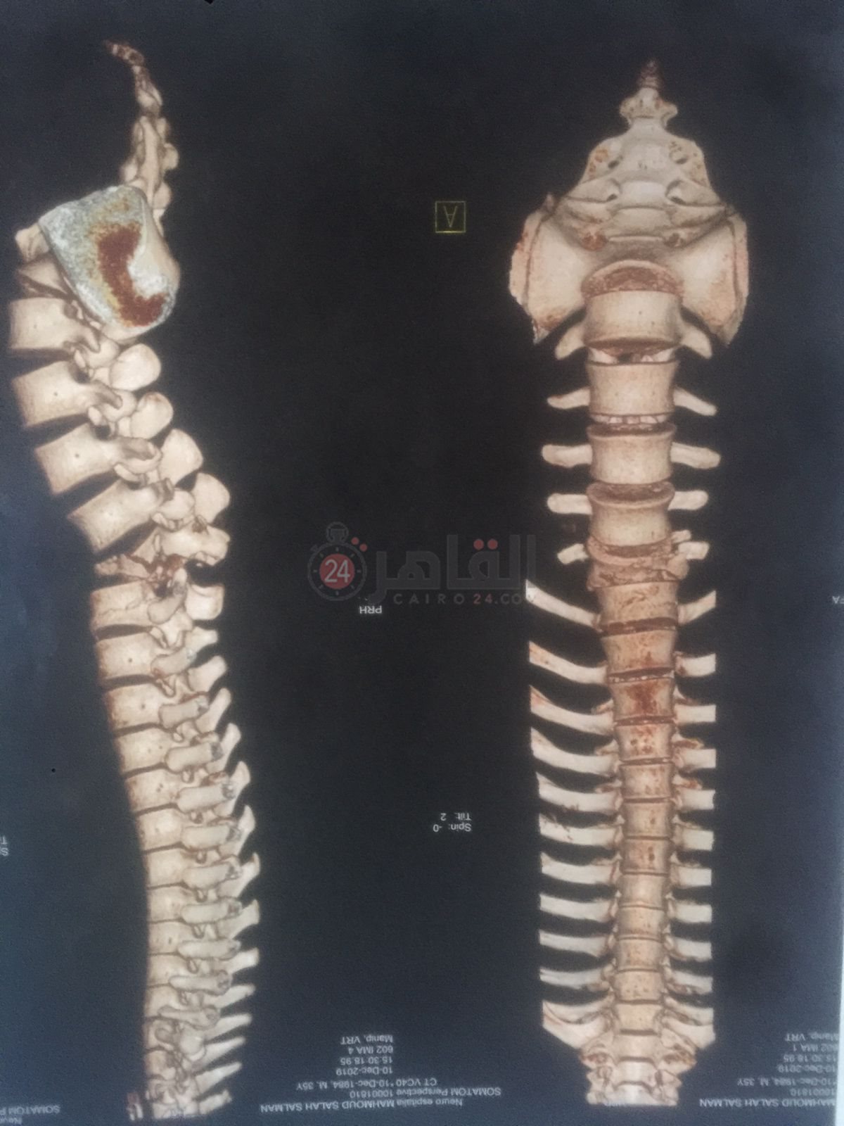 67167413-f0ef-40fa-9f3d-a7894fbef9c9 (1)