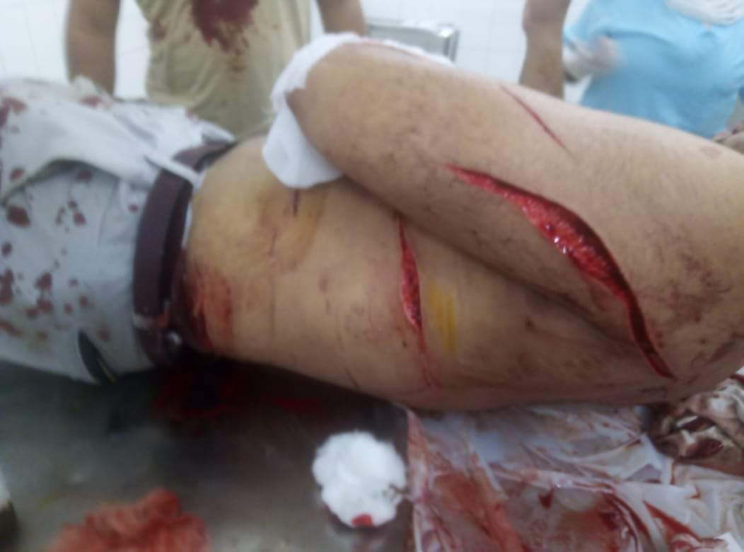 التعدي على شاب بالفيوم