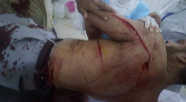 المُعتدى عليه في الفيوم