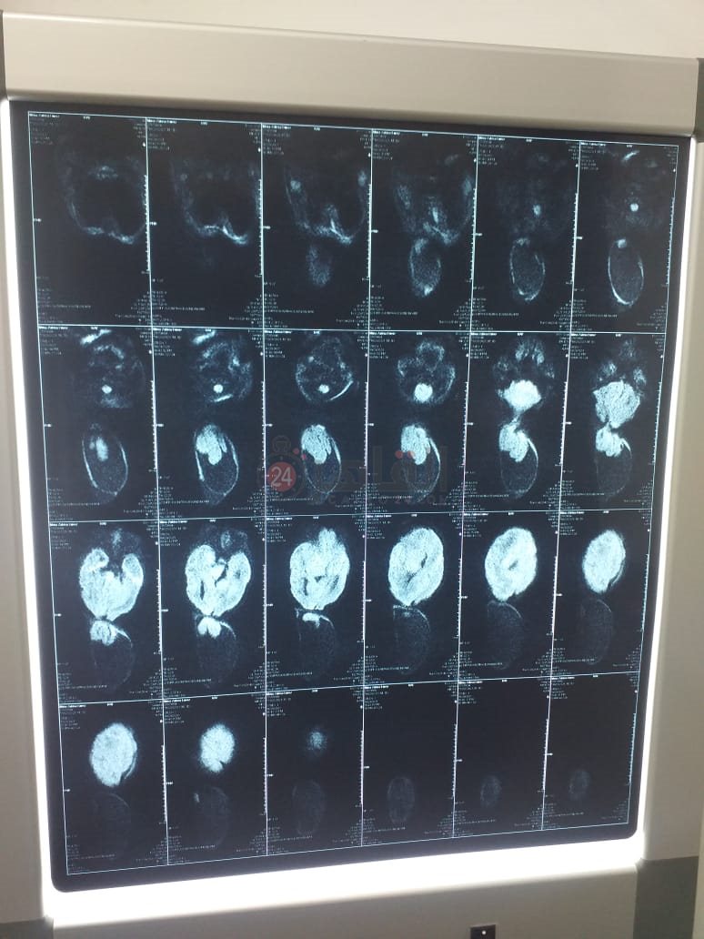 6c2b1aec-d690-465f-8787-113f0506872d