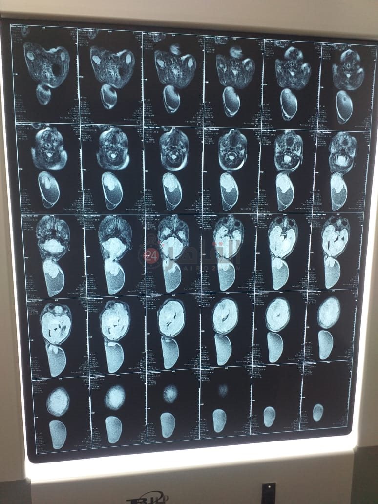 7842296f-d7b3-4eb8-8844-6c2cd2c7c557