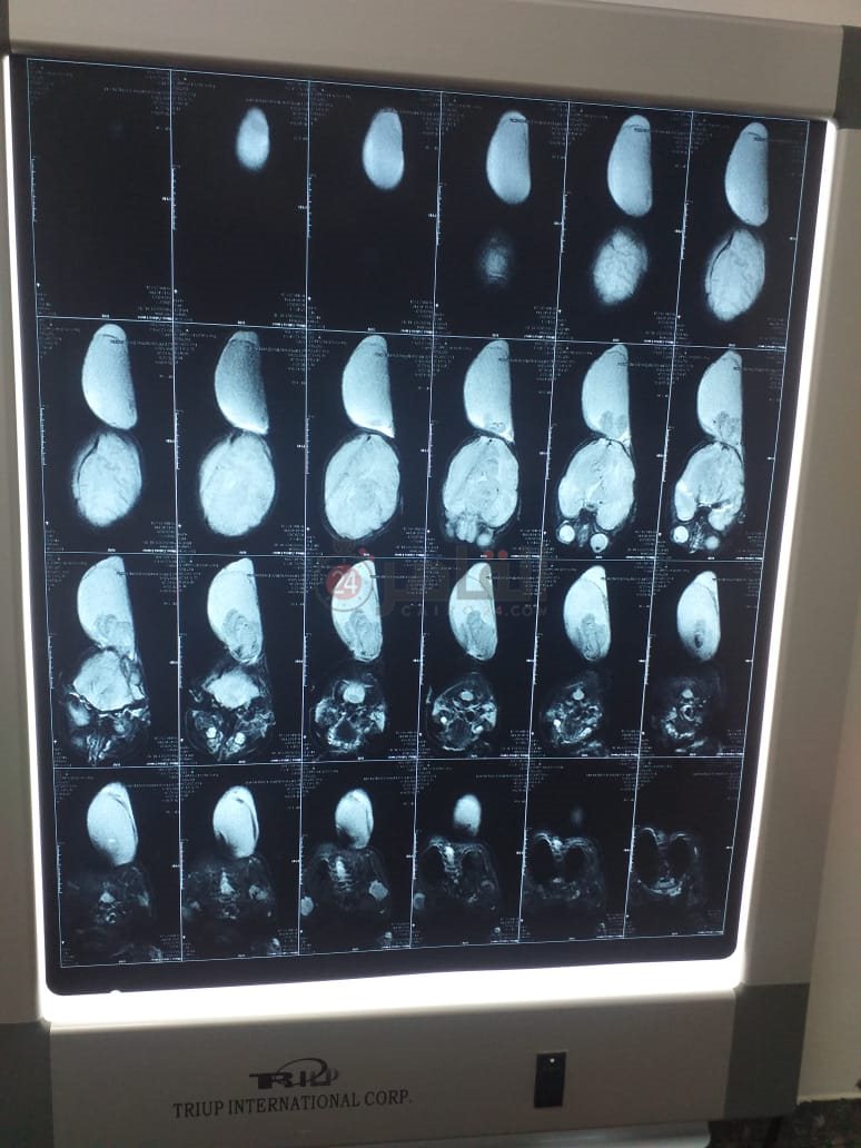 b19a5b94-4d54-471f-8657-515a2af262fa