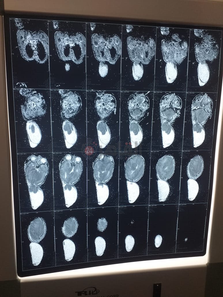 ee4fa3bc-034b-4fdd-8abc-a7543d241178