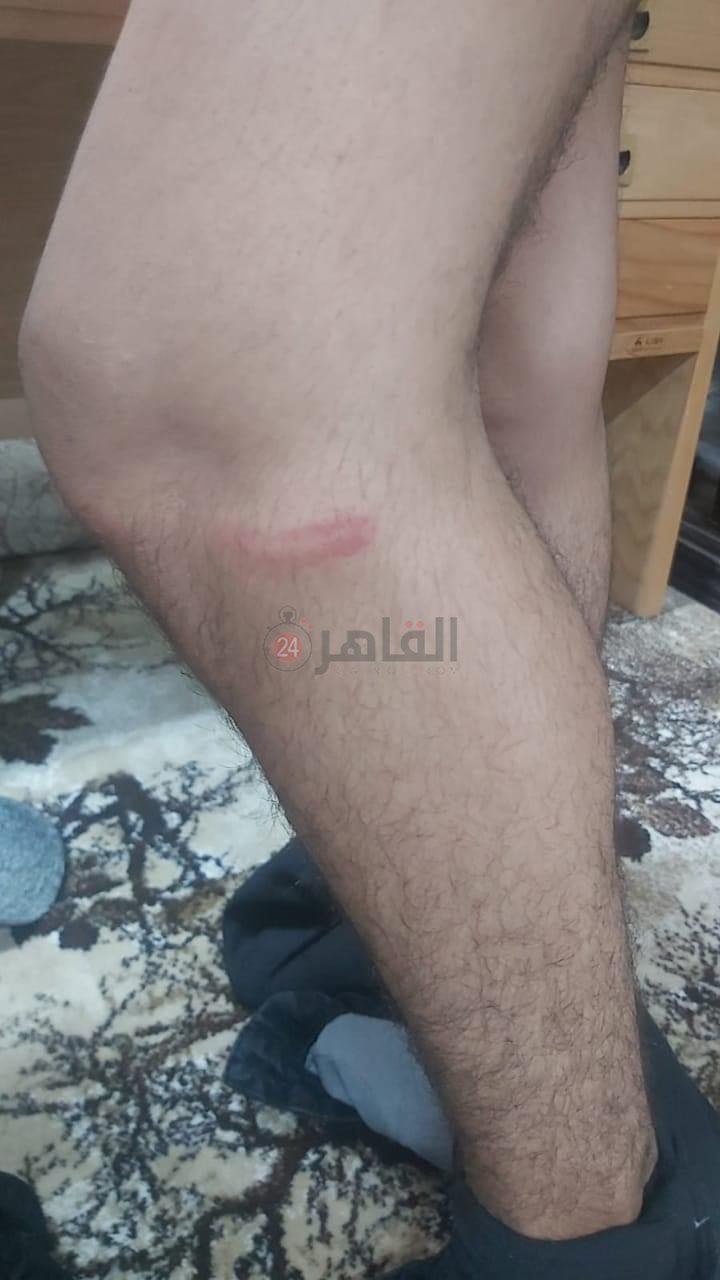 تعدي مدرس على طالب 