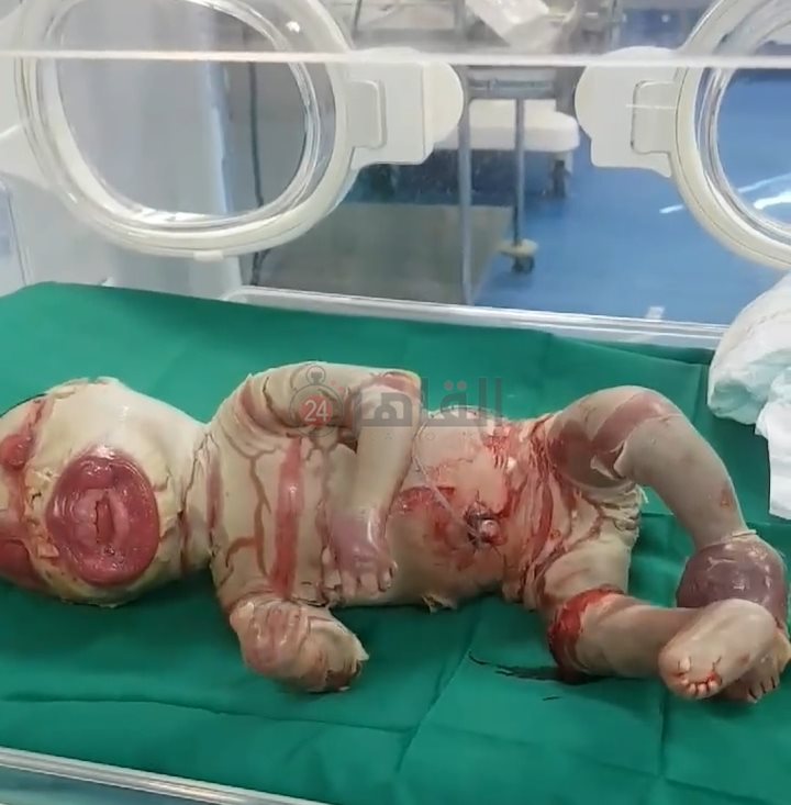 IMG_٢٠٢٢٠١٢٦_١١٥٥٤١