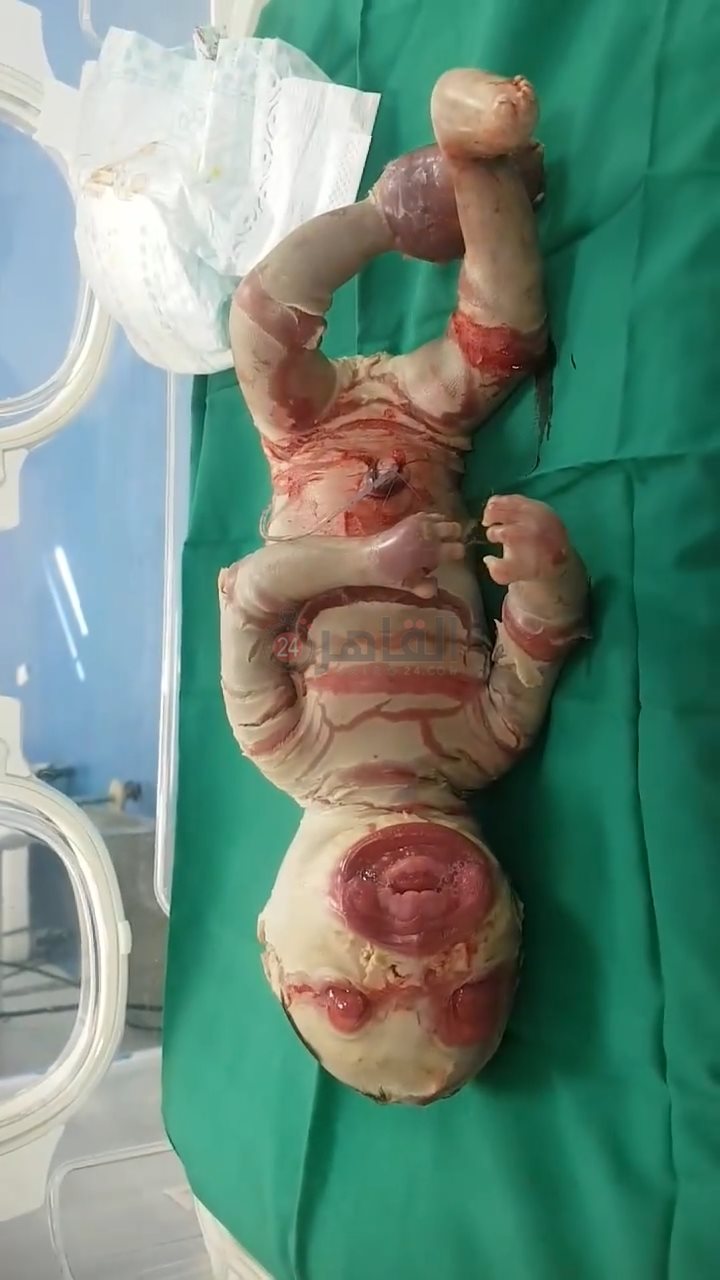 IMG_٢٠٢٢٠١٢٦_١١١٤٣٩٥٧