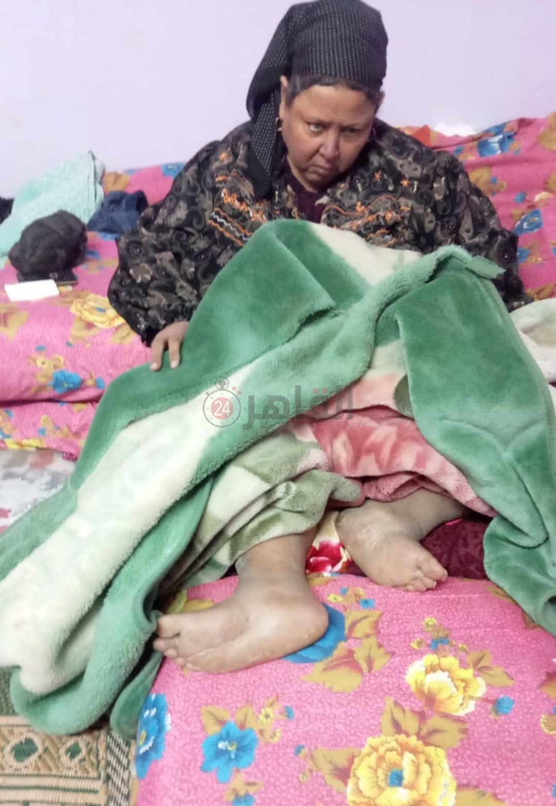 السيدة المريضة بقدمها