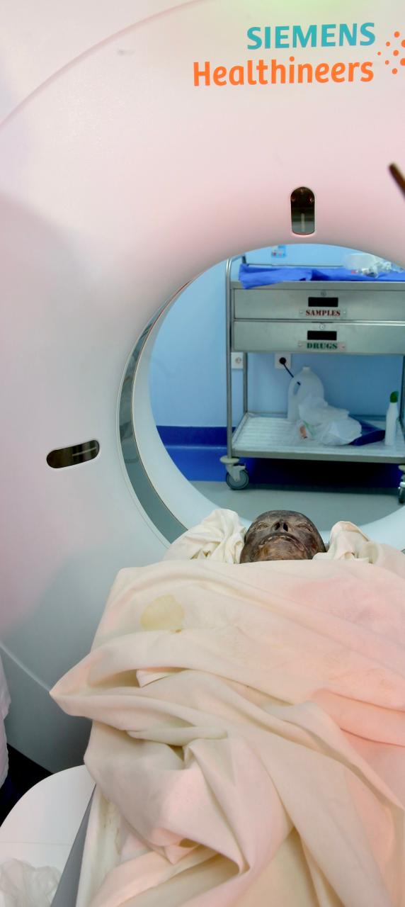 مومياء فرعونية بمستشفى أورمان الأقصر