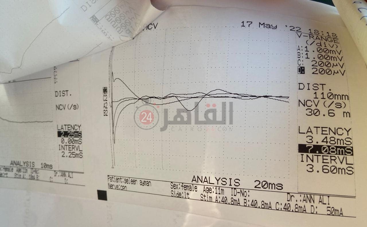 71d872e8-3609-4732-8e65-34189df77952