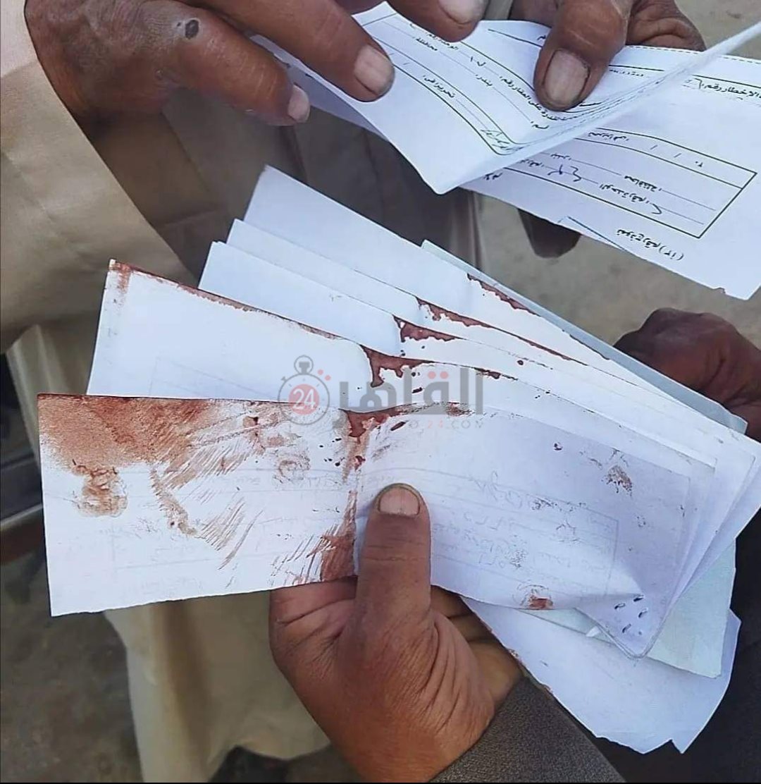 الإيصالات وعليه آثار دماء المجني عليه