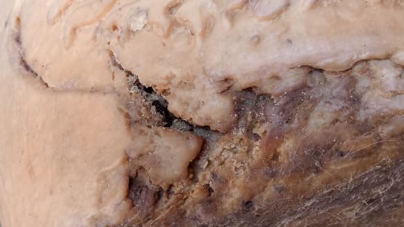 رؤية الدود في المنام للرجل