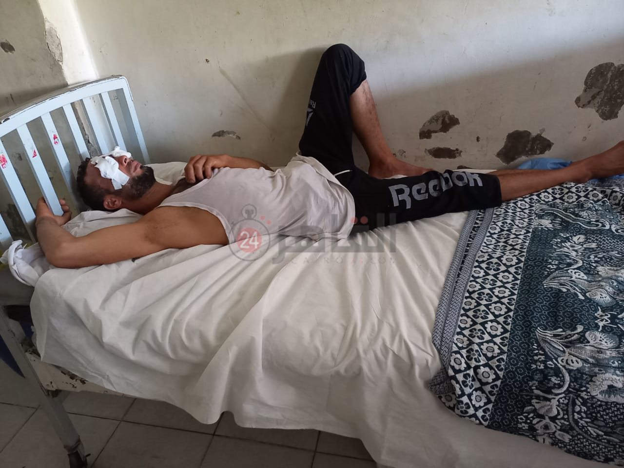 الشاب المصاب بطلقات خرطوش