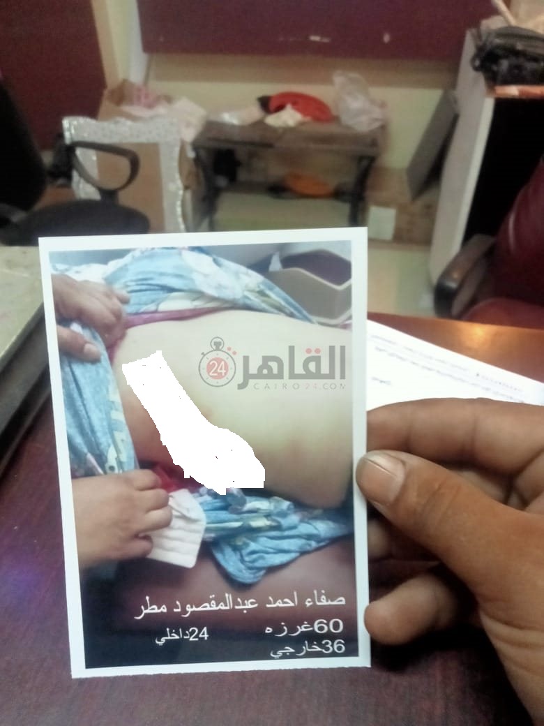 صورة إصابة المجني عليها صفاء