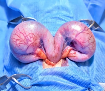 آثار التدخل الجراحي