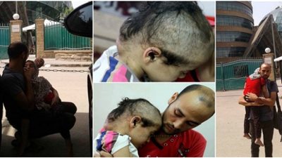 جنى ماتت.. رحلة طفلة انتصر السرطان عليها بعد فشل محاولات علاجها فى مستشفيات مصر