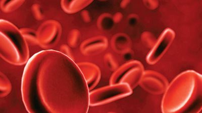 أستاذة طب أمراض دم الأطفال: مصر الأولى عالمياً في الإصابة بمرض أنيميا البحر المتوسط