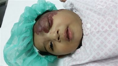 عامل ينهال بالضرب على رضيعته ويصيبها بنزيف فى المخ: مش عايز بنات