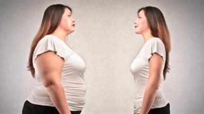 جراحات السمنة المفرطة تساعد على الشفاء من الأمراض المزمنة بنسبة 80%