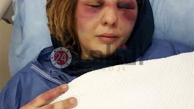 خاص.. زوج يعذب زوجته 3 أيام ويطعنها بالسكين بسبب صورة خلخال (صور)