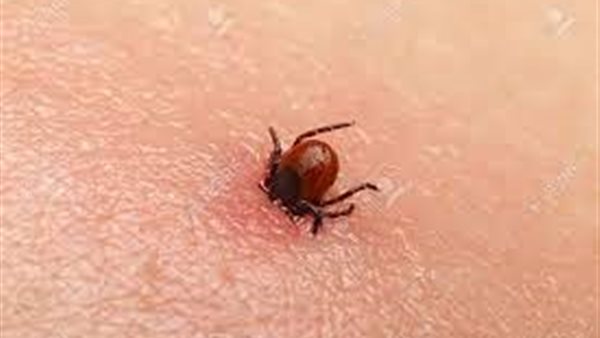 التهاب الدماغ