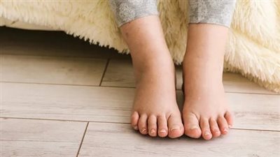 تورم الكاحلين.. علامات تحذيرية تشير إلى خطر الإصابة باعتلال الكلى السكري