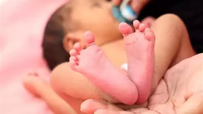 بـ جلد شمعي لامع يشبه البلاستيك.. ولادة طفل خلال 36 أسبوعا باضطراب نادر 