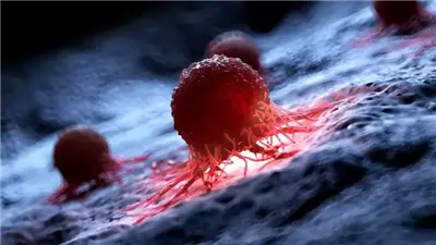 اكتشاف لقاح جديد يقلل من احتمالية عودة سرطان الجلد