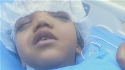 وفاة الطفلة صباح ضحية دهس السائق المتهور بعين شمس