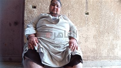 وزنه 300 كيلو.. شاب من بني سويف مصاب بداء الفيل يستغيث لعلاجه: مش بعرف أنام| فيديو 