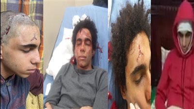 هشموا رأسة بالرخام.. اعتداء وحشي على طالب بسبب مباراة كرة قدم ببورسعيد| صور وفيديو
